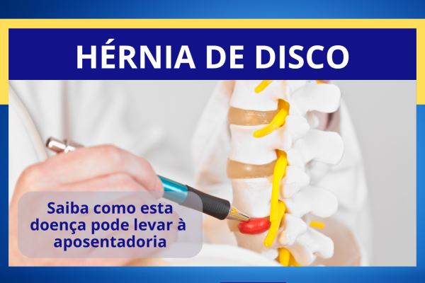 Como evitar que o INSS negue sua Perícia Médica (9)